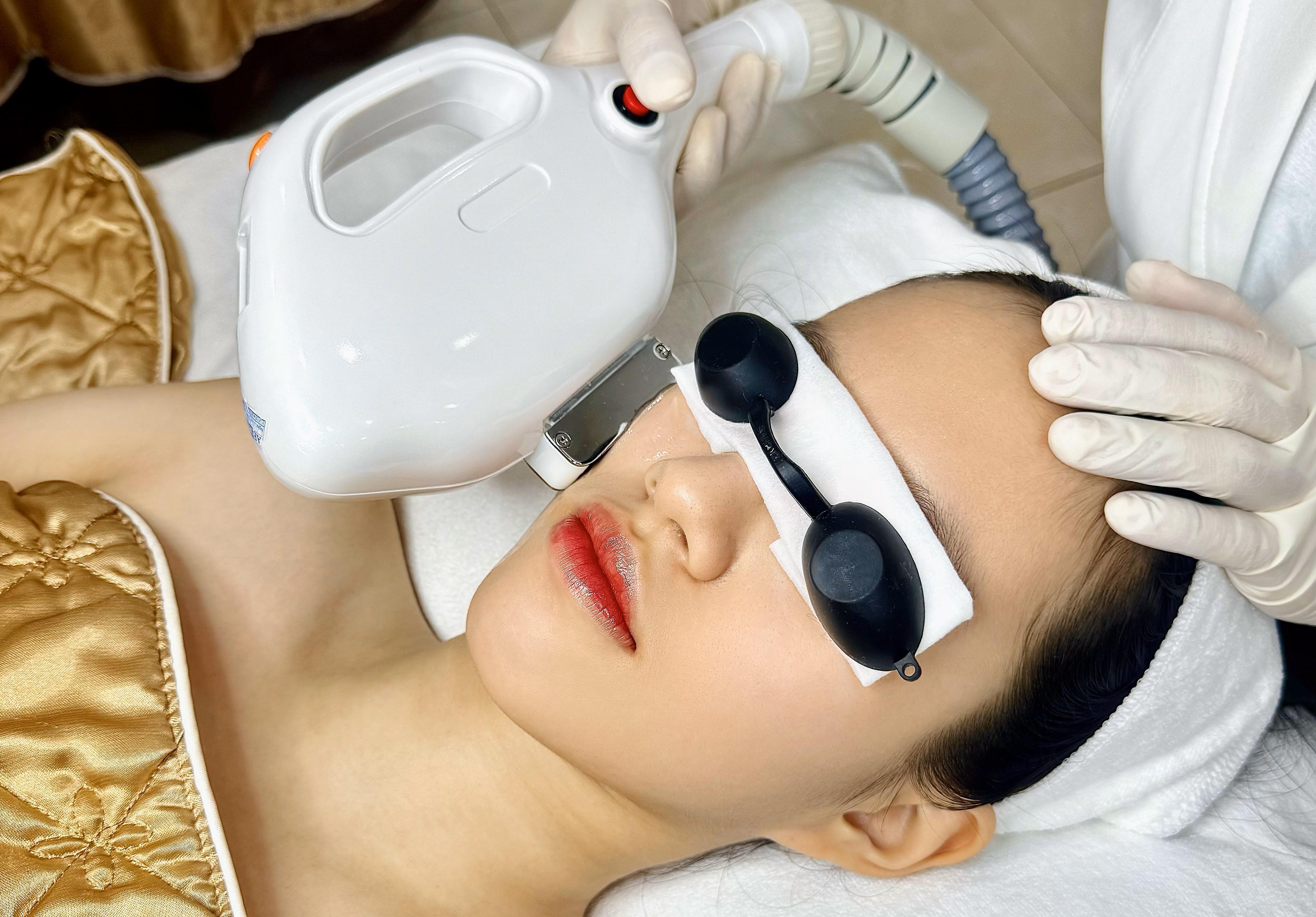 Điều trị mụn bằng laser